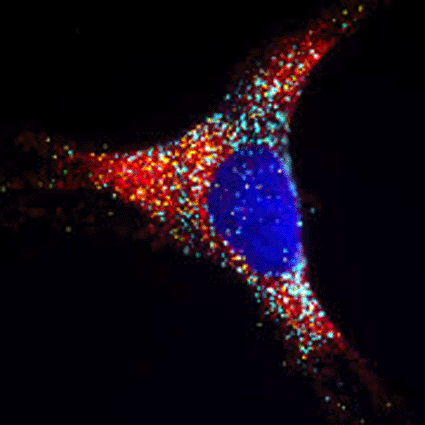 Image: In situ detection of four mRNA transcripts by RNAscope. Each dot represents a single RNA molecule (photo courtesy Advanced Cell Diagnostics).